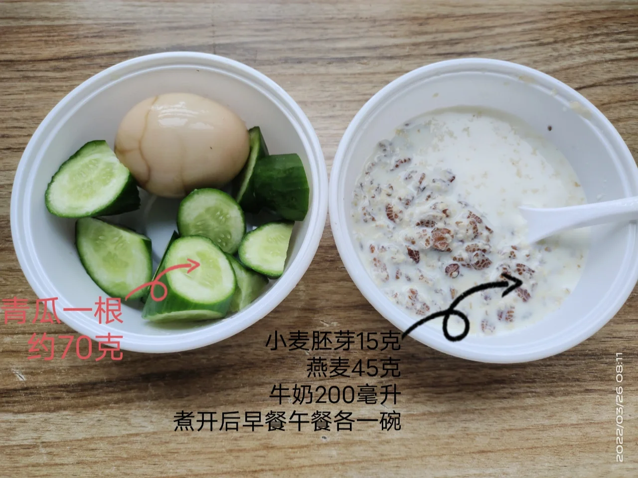 糖尿病妈妈➕试管宝宝